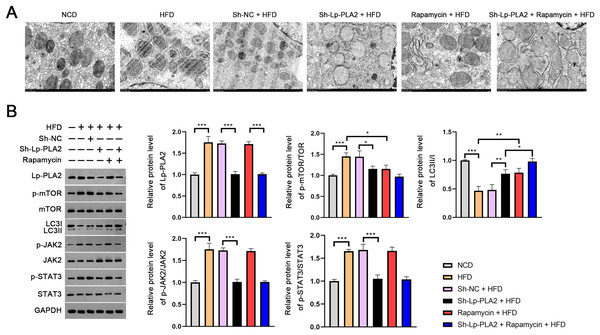 Lp-PLA2 silencing promotes autophagy and inhibits the JAK2/STAT3 pathway in HFD-induced NASH mice.