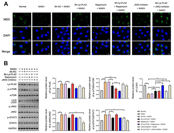 Lp-PLA2 silencing promotes autophagy via deactivating the JAK2/STAT3 pathway in Kupffer cells induced with NASH.