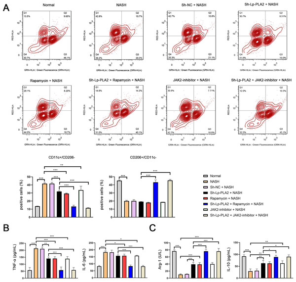 Lp-PLA2 silencing inhibits M1 polarization of Kupffer cells induced with NASH.