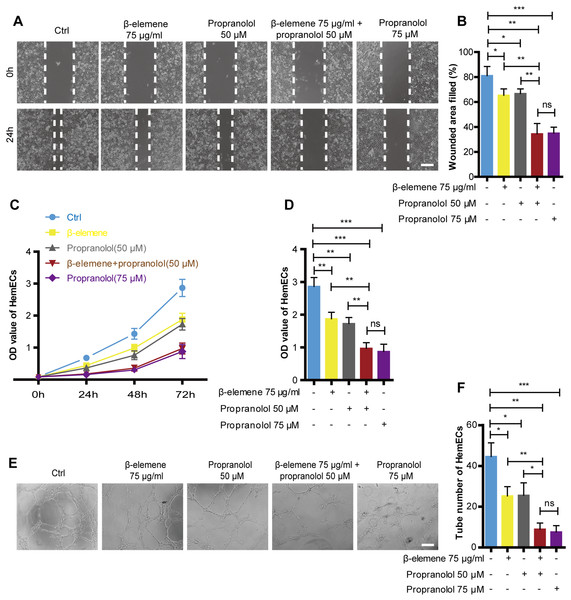 Combinatorial treatment of β-elemene and propranolol inhibited the migration and proliferation and tube formation of HemECs.