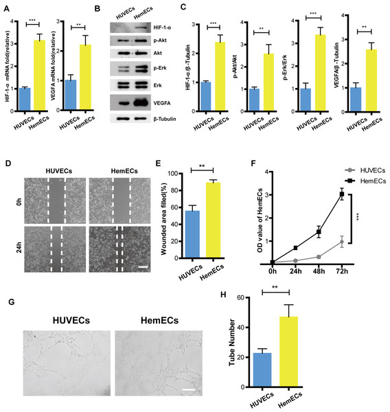 HIF-1- α/VEGFA signaling pathway was activiated in hemangioma.