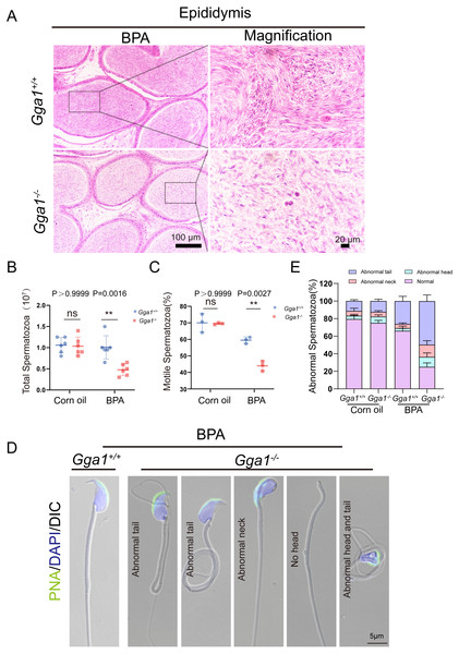 Sperm quality was significantly reduced in BPA-exposed Gga1-/- male mice.