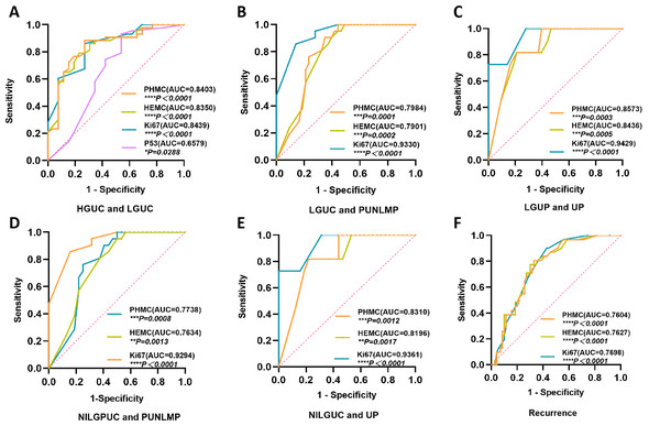 The ROC curves of PHMC, HEMC, Ki67 and P53 in the diagnosis of different exophytic papillary urothelial neoplasms and the prediction of recurrence.
