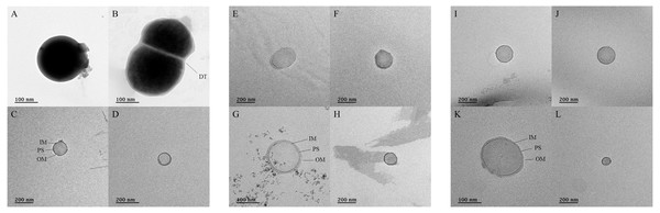 Transmission electron micrographs for ultramicrobial communities after ultra-section of fermented cabbages.