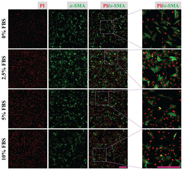 Activation of CFs regulated by FBS.