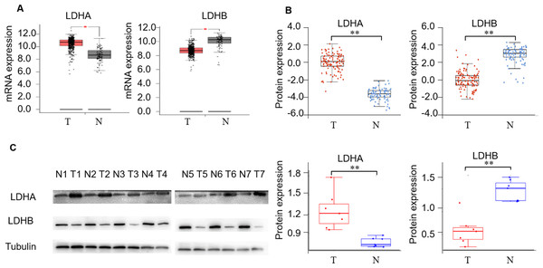 The expression profiling of LDHA and LDHB in ccRCC tissues.