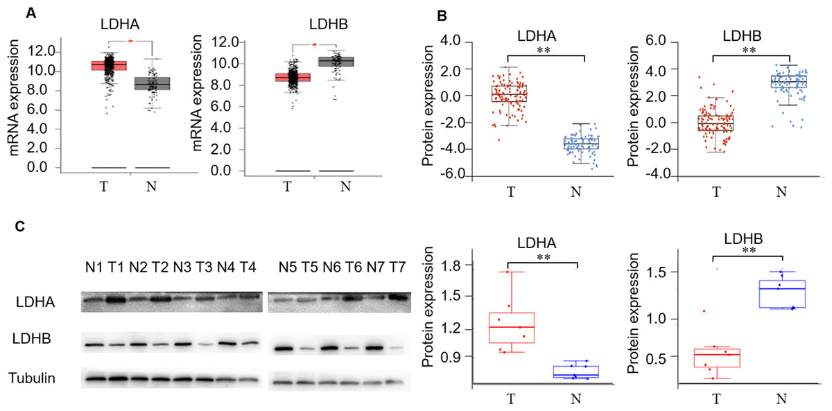 The novel role of LDHA/LDHB in the prognostic value and tumor-immune ...