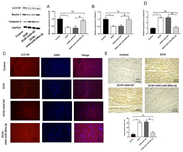 miR-200a-3p affected diabetes induced-autophagy and apoptosis.
