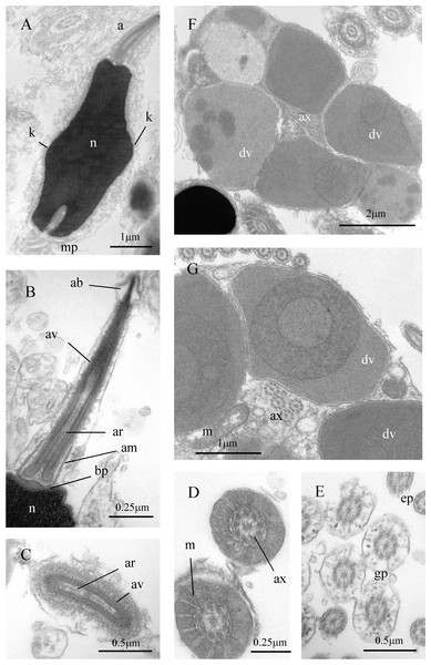 Sperm ultrastructure of Cayo galbinus. n. sp.