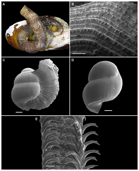 Shell morphology and radula of Thylacodesdecussatus.