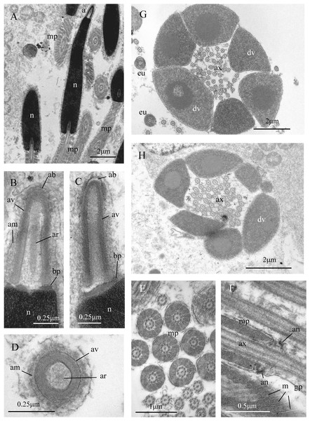 Sperm ultrastructure of Thylacodes decussatus.