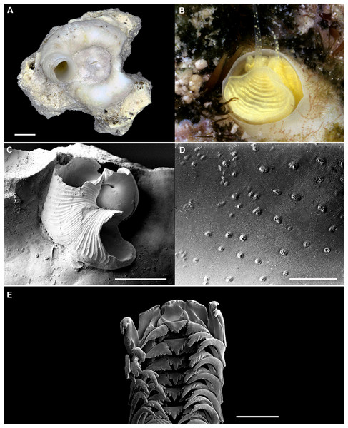 Shell morphology, living coloration, and radula morphology and radula of Cayo margarita n. sp.