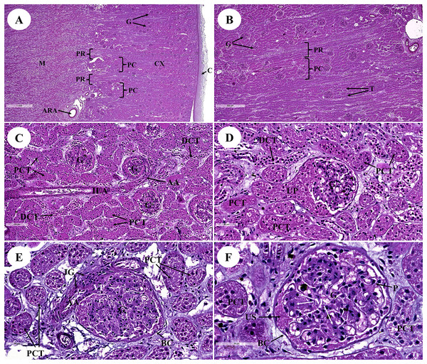 Low and high magnification of histological sections of the renal cortex and medulla (A and B), renal tubules and renal vessel (C and D) and glomerulus complex (E and F).