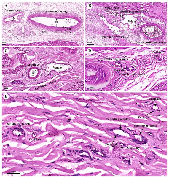 Low and high magnification (15× to 40×) of histological sections of the coronary vessels (coronary artery and coronary vein) (A), small muscle artery and small muscle vein (B), arterioles and venules (C), the various diameters of arterioles, venules, and capillaries of the general tissue organ (D) and he smallest arterioles, collecting venules and capillaries (E).