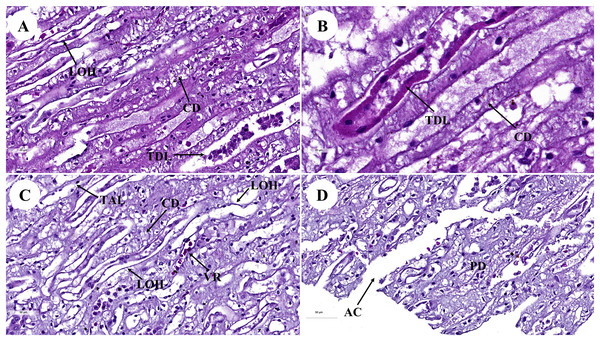 Low and high magnification of histological sections of renal medulla; straight tubules (A and B), loop of Henle and collecting duct (C) and renal papilla (D).