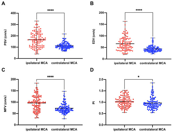 Comparison of ultrasound parameters between ipsilateral (recanalized) and contralateral MCA.