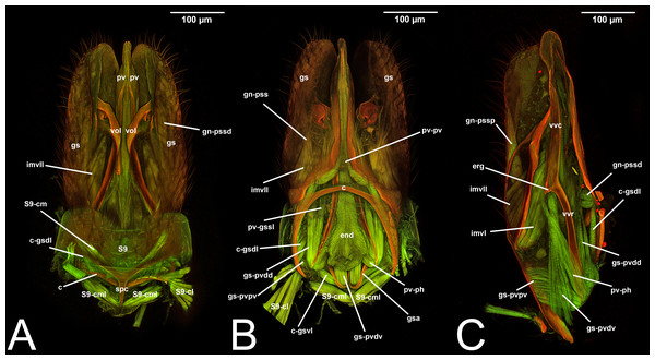 CLSM volume rendered images of male genitalia of Temelucha sp. (Ichneumonidae: Cremastinae). (A) Ventral view. (B) Dorsal view. (C) Median view.