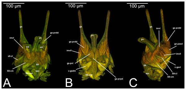 CLSM volume rendered images of male genitalia of Mesochorus sp. (Ichneumonidae: Mesochorinae). (A) Ventral view. (B) Dorsal view. (C) Lateral view.