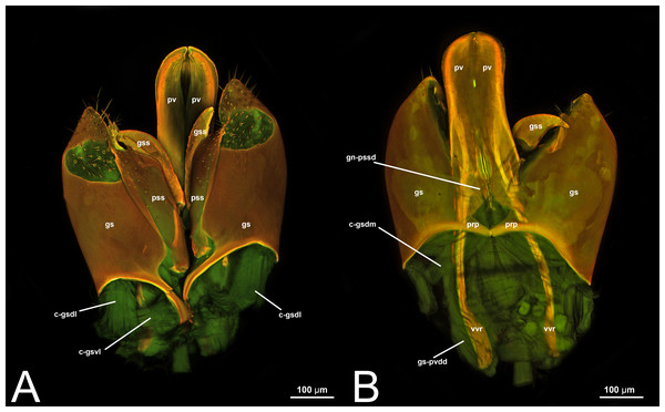 CLSM volume rendered images of male genitalia of Neoxorides pilosus (Ichneumonidae: Poemeniinae). (A) Ventral view. (B) Dorsal view.
