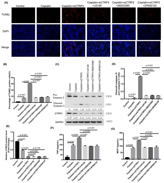 Effect of the inhibitors of MAPK pathway on cisplatin-induced inflammation and apoptosis.