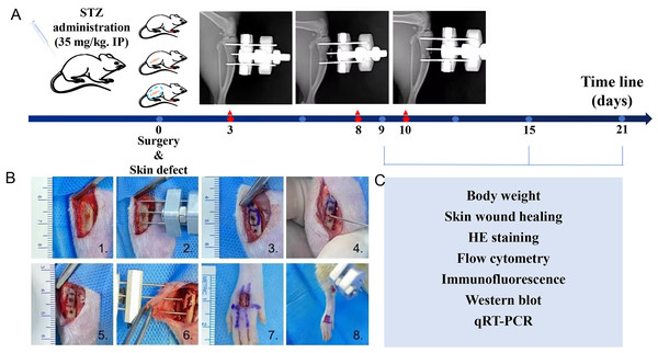 Introduction of diabetic rats model, tibial transverse bone transport (TTT) surgical procedure and workflow.