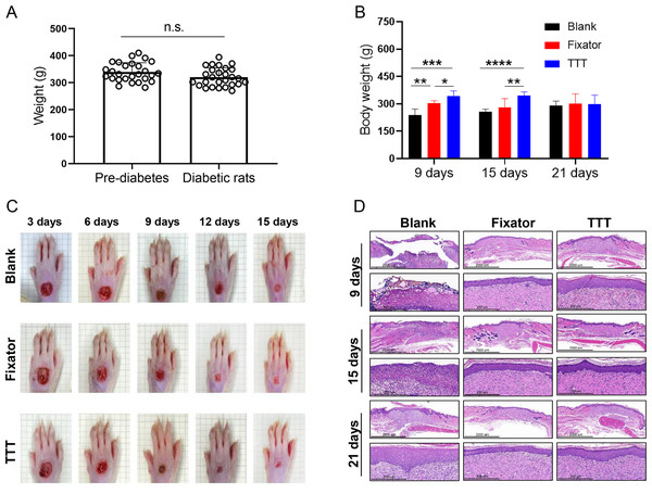 The effects of tibial transverse transport (TTT) technique on body weight and skin recovery in diabetic rats.