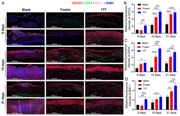 TTT could effectively increase CD34/CD133 and SDF-1 expression in wound skin.