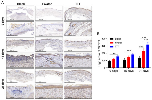 TTT activated CXCR4 signal pathway and promoted cell apoptosis.