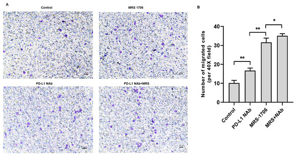 Treatment with MRS-1706 and CD274 synergistically increased natural killer (NK) cell recruitment in oral squamous cell carcinoma (OSCC) cells.