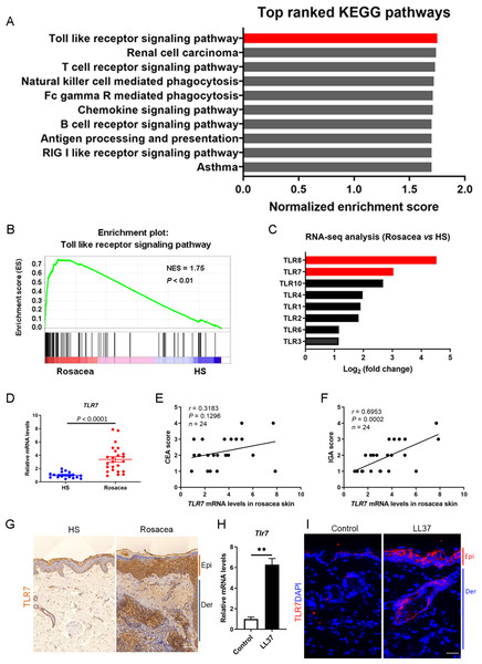 TLR7 is overexpressed in rosacea.