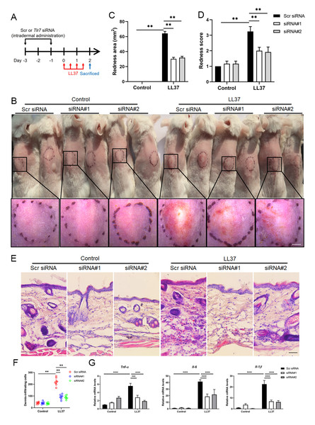 TLR7 deficiency alleviates rosacea development.