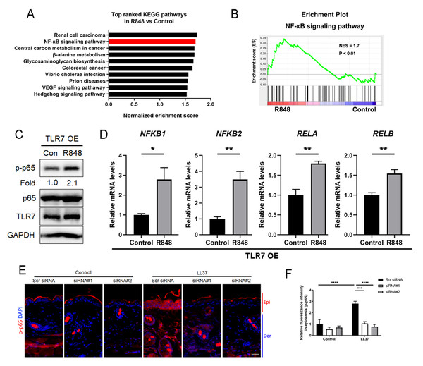 Stimulation of TLR7 activates NFκB signaling in keratinocytes.