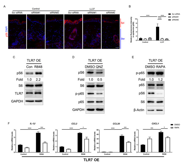 Attenuated TLR7/NFκB signaling regulates rosacea-associated cytokine and chemokine production through inhibition of mTORC1 signaling.