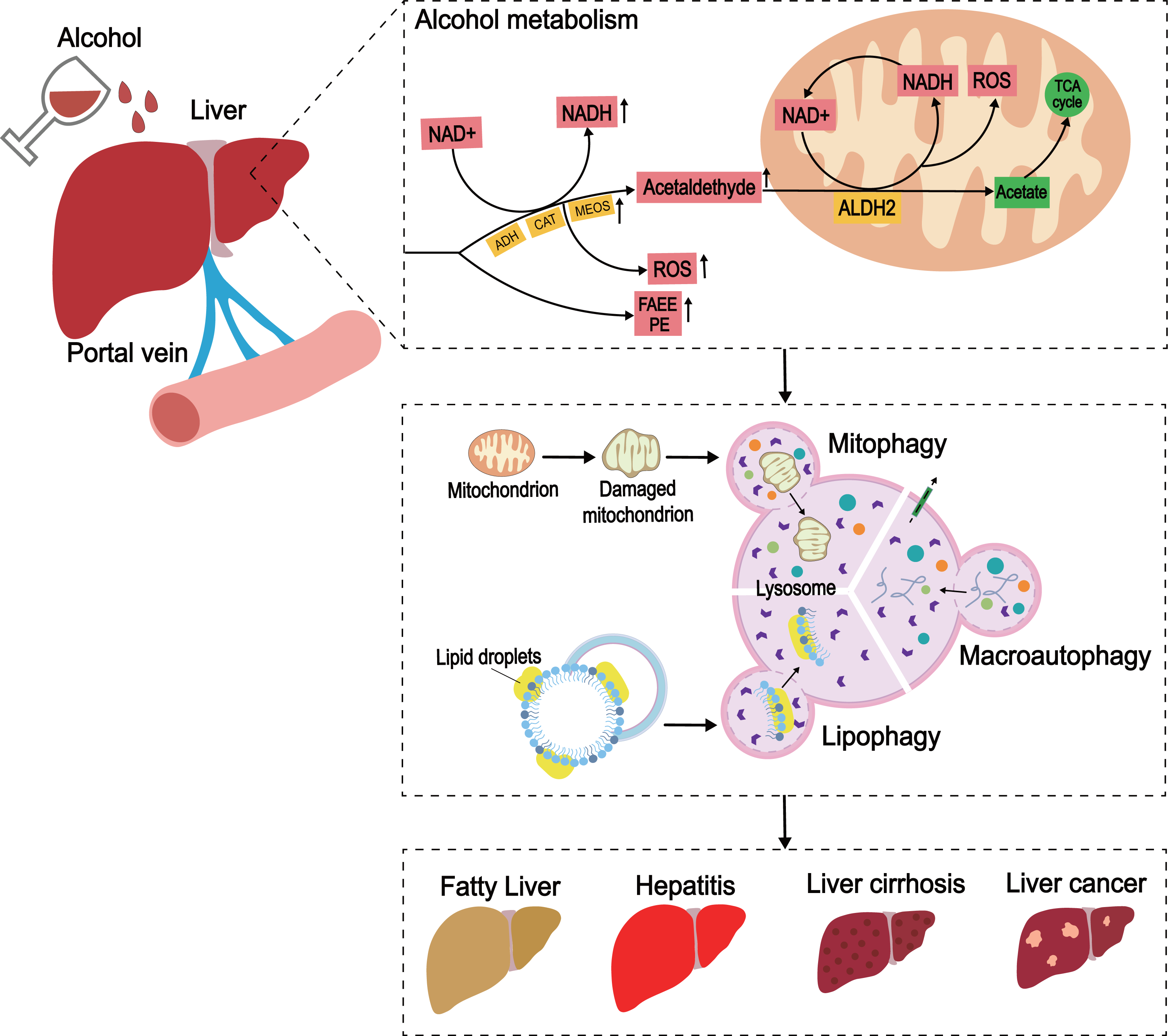 Progress in the mechanism of autophagy and traditional Chinese 