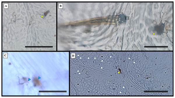 Impression of the S. erecta Radlk (Sapindaceae) epidermis in light microscopy.