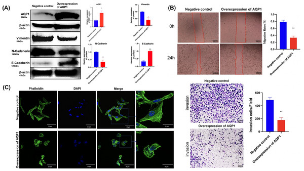 Overexpression of AQP1 suppresses the migration and invasion of WT cells in vitro.