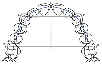 Relationship between vertical facial morphology and dental arch