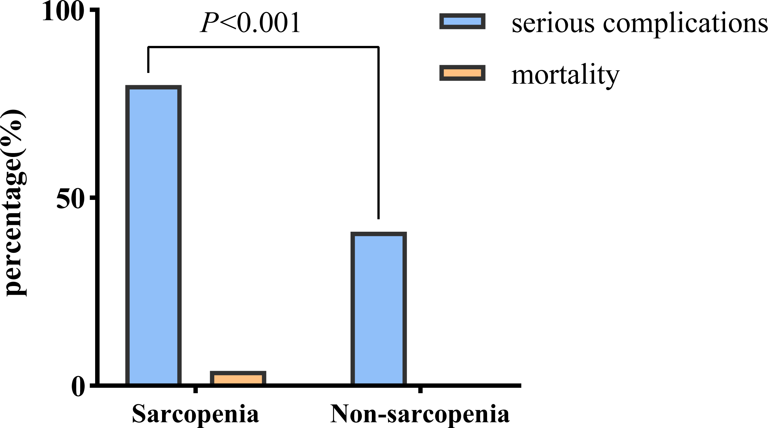 Impact of Sarcopenia on Outcomes Following Resection of Pancreatic  Adenocarcinoma