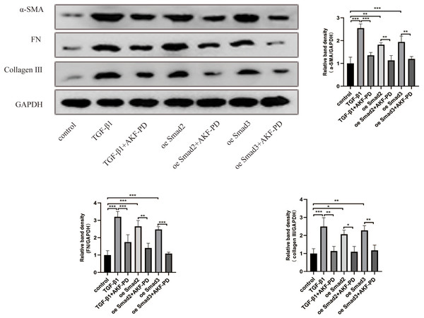 AKF-PD alleviated liver fibrosis by inhibiting the TGF-β1/Smad pathway in cultured HSCs.