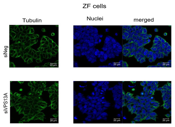 Confocal laser scanning microscopy of α-tubulin and nuclei in chorein-silenced (siVPS13A) and control (siNeg) ZF rhabdomyosarcoma tumor cells.