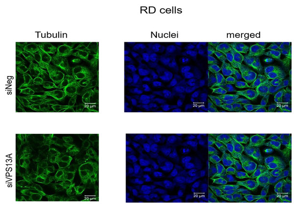 Confocal laser scanning microscopy of α-tubulin and nuclei in chorein-silenced (siVPS13A) and control (siNeg) RD rhabdomyosarcoma tumor cells.