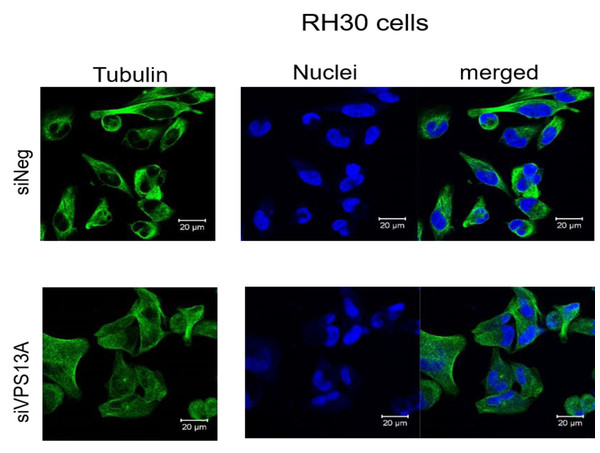 Confocal laser scanning microscopy of α-tubulin and nuclei in chorein-silenced (siVPS13A) and control (siNeg) RH30 rhabdomyosarcoma tumor cells.