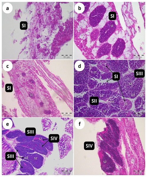 Histological sections of Dendrophyllia ramea reproductive tissues of a male colony.