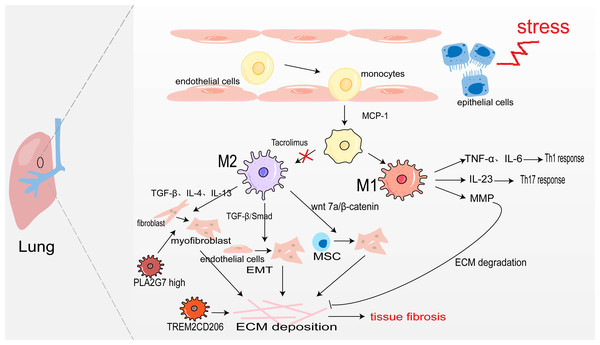 Macrophages in lung fibrosis.