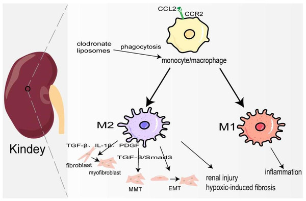 Macrophages in kindey fibrosis.