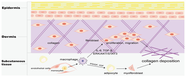 Macrophages in skin fibrosis.