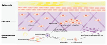 Macrophage polarization in tissue fibrosis [PeerJ]