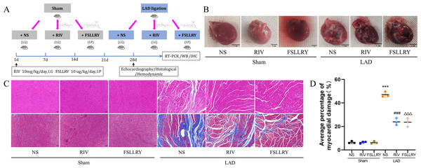 RIV and FSLLRY improves cardiac morphological changes in MI Rats.