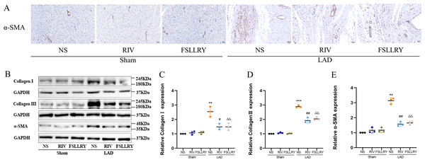 RIV and FSLLRY attenuated myocardial fibrosis in MI Rats.