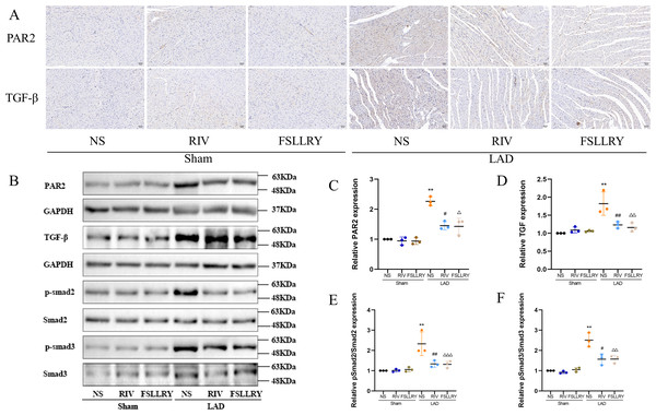 RIV inhibited TGFβ-related signaling pathways in MI rats.